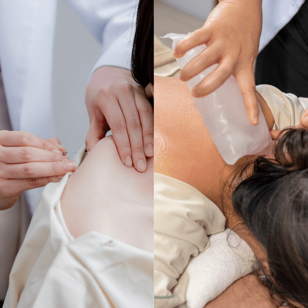 Dry Needling & TCM Fusion