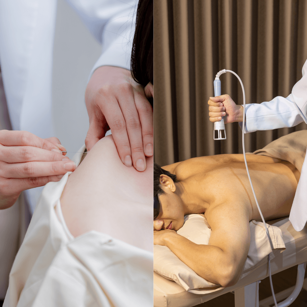 Dry Needling & PT